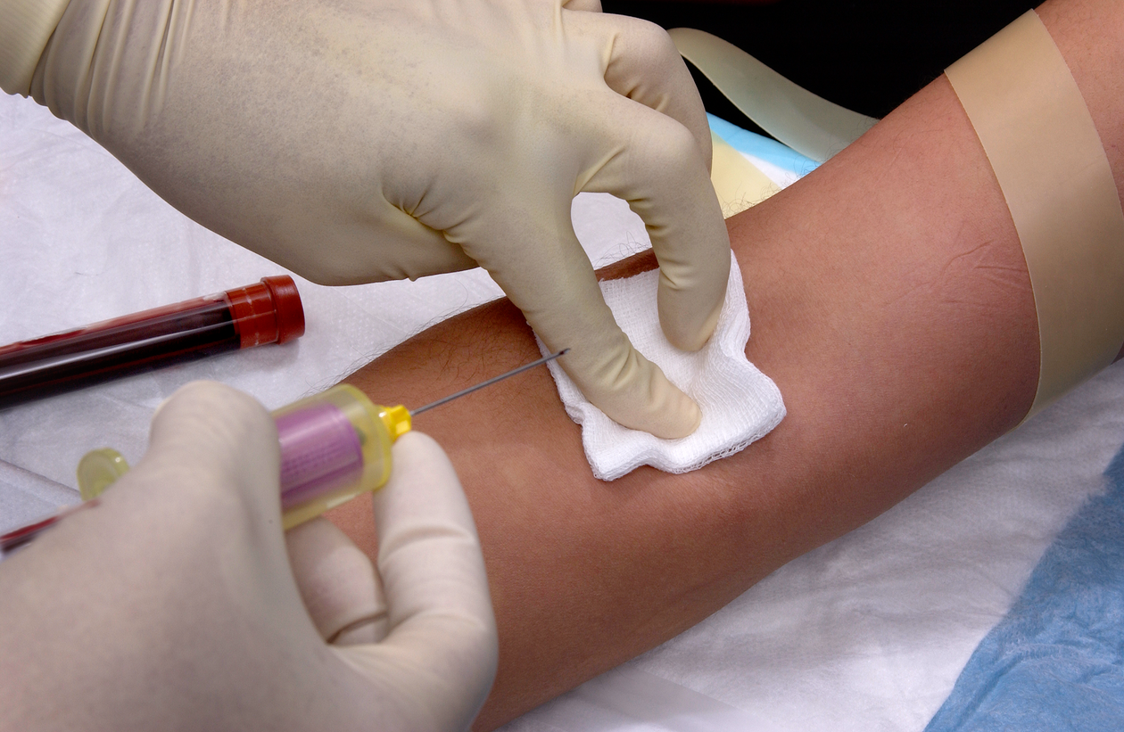 Paraphernalia and steps to be followed when a trained phlebotomist obtains a blood sample by way of a venipuncture, using the contents of a Vacutainer® kit. Courtesy of the Public Health Image Library, Centers for Disease Control and Prevention.
